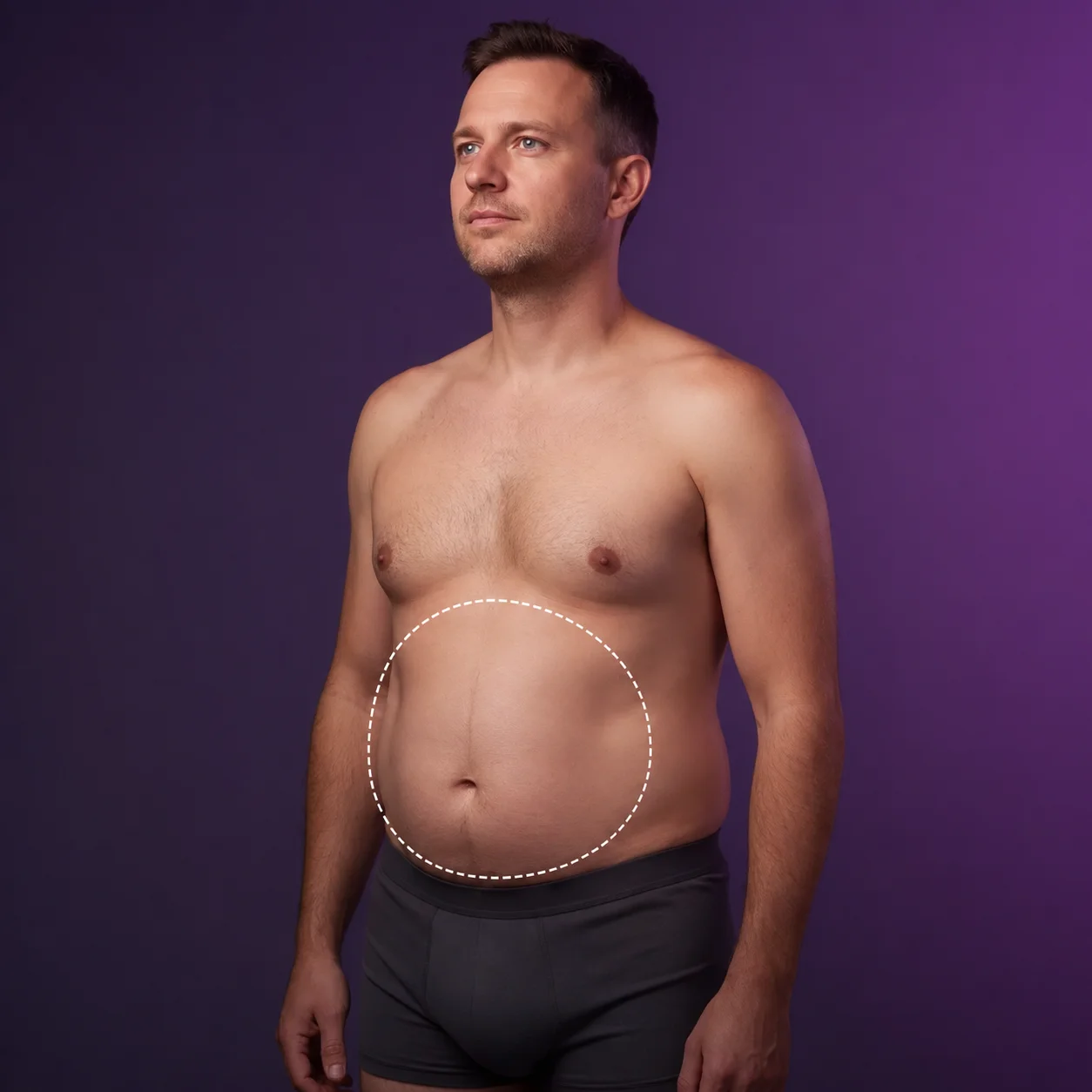 Fettabsaugung Bauch beim Mann – markierte Behandlungszone