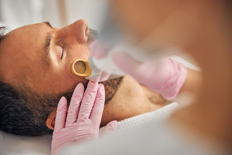 Das Foto zeigt einen Mann der gerade seinen Bart gelasert bekommt und verdeutlicht das Thema „Dauerhafte Haarentfernung durch Laserbehandlung“.