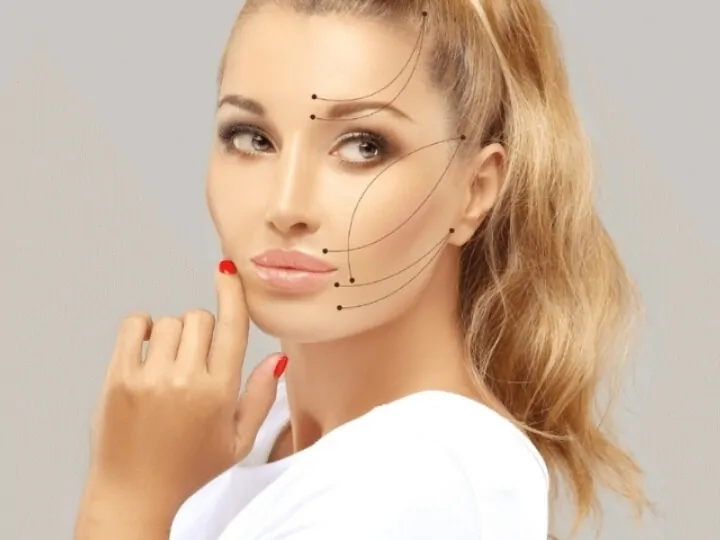 Das Titelbild zeigt eine Frau mit eingezeichneten Linien für das PDO Fadenlifting im Gesicht.