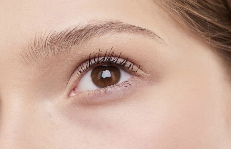 Das Foto verdeutlicht den Effekt eines Augenbrauenliftings (Brow Lift).