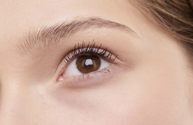 Das Foto verdeutlicht den Effekt durch das Augenbrauen-Lifting (Brow Lift).