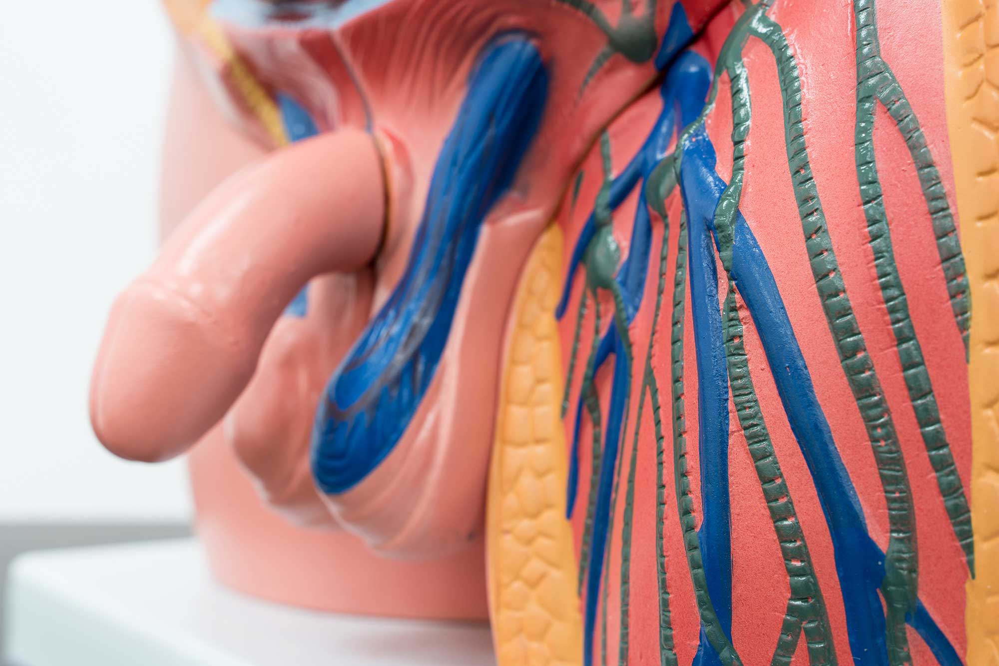 Das Foto zeigt ein anatomisches Model, das die Eichelvergrößerung verdeutlicht.