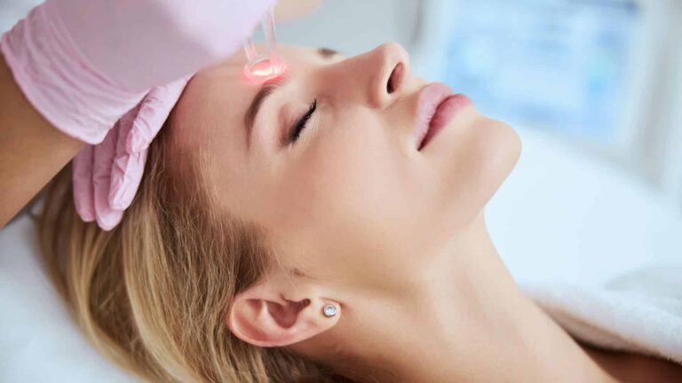 Das Foto zeigt eine CO₂-Laserbehandlung bei Medicalthree.