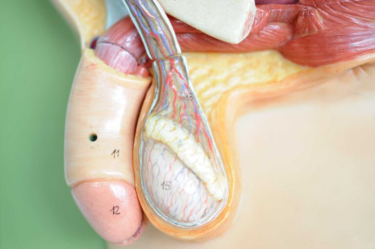 Anatomisches Modell eines männlichen Hodens mit Samenleiter und Blutgefäßen – medizinische Darstellung im Kontext einer Vasektomie.