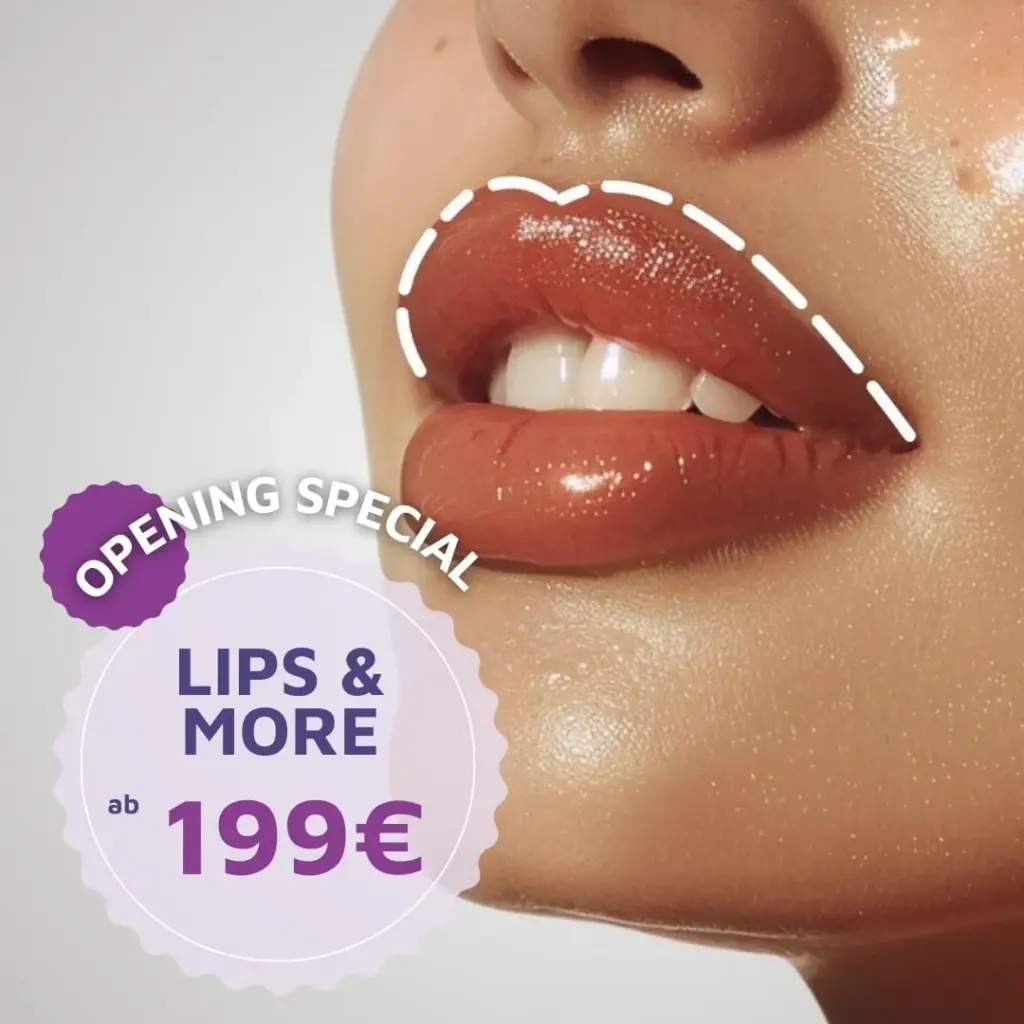 Nahaufnahme von glänzenden, voluminösen Lippen mit weißer Markierungslinie, daneben ein violettes Label mit der Aufschrift „Opening Special – Lips & More ab 199 €“.